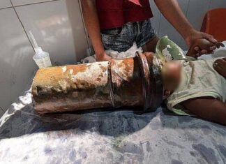 Menino de apenas 2 anos fica com a cabeça presa em tubo de aço