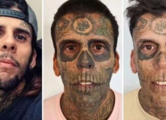 Homem mais tatuado do Brasil inicia remoção de tatuagens faciais e motivo é surpreendente
