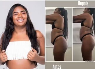 Irmã do ex-BBB Davi, Raquel Brito mostra antes e depois de procedimento e vira piada na web