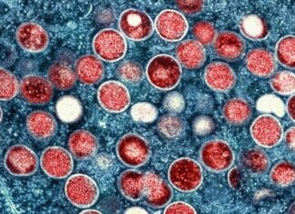 Nova cepa da mpox é identificada no Brasil; paciente teve contato com familiar do Congo