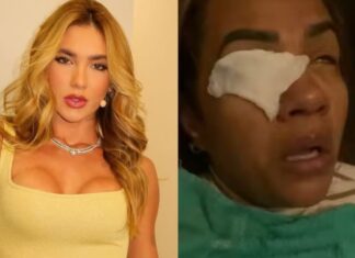 Consumidora relata queimadura nos olhos após usar cosmético da marca de Virginia Fonseca