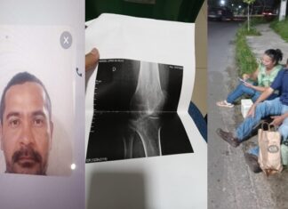 Motorista venezuelano expulsa paciente de hemodiálise de carro de app e vítima sofre fratura