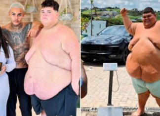 Influenciador Gordão da XJ perde 115 kg e atinge peso para bariátrica