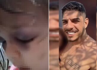 Menina de 3 anos é vítima de agressão severa; padrasto permanece foragido