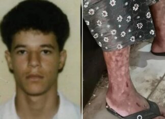 Filho controlava pensão da mãe e a impedia de se alimentar e realizar exames
