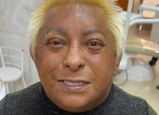 Patixa Teló exibe novo sorriso após cirurgia de implantes dentários