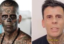 Tratamento com laser transforma rosto do ‘mais tatuado do Brasil’ após conversão evangélica