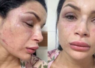 Musa de escola de samba é agredida em emboscada durante corrida por aplicativo em Manaus