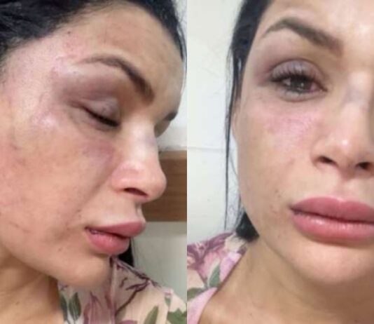 Musa de escola de samba é agredida em emboscada durante corrida por aplicativo em Manaus