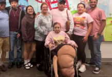 Menina passa por cirurgia de 17 horas para amputar uma perna de cerca de 77 quilos