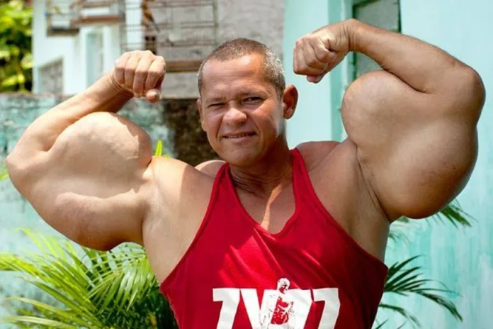 10764821-arlindo-de-souza-conhecido-como-popeye-brasileiro-1