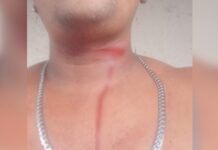 Jovem fica ferido após ser atingido por linha cortante de papagaio