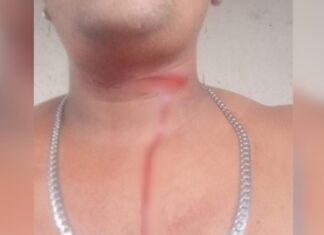 Jovem fica ferido após ser atingido por linha cortante de papagaio