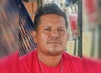 Suspeito de atear fogo na ex-companheira é procurado após vítima sofrer queimaduras graves
