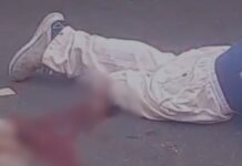 Acidente grave na zona oeste de Manaus deixa motociclista mutilado na avenida do Turismo