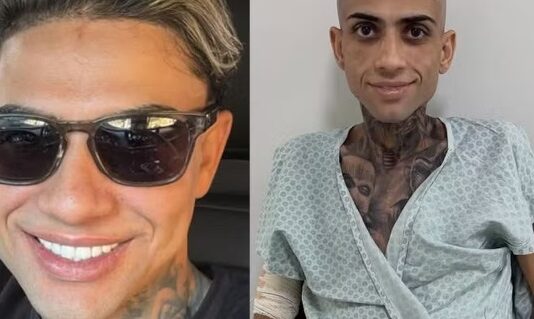 Morre Jota Surfista, influenciador que lutava contra câncer e cirrose hepática