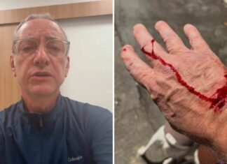 Apresentador da Globo relata ataque de pitbull sem guia e cobra responsabilidade