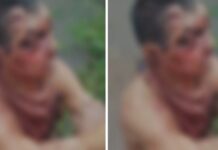 Homem quase mata idoso por causa de R$ 25 e deixa vítima desacordada no mato no interior do AM
