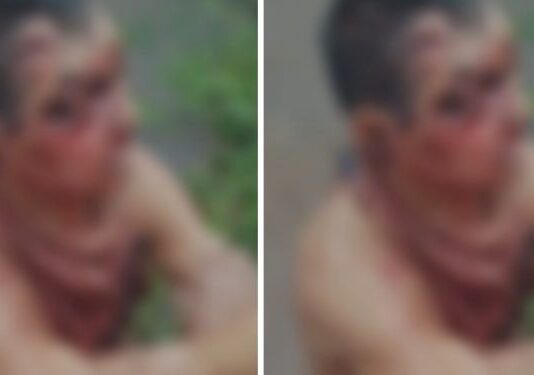 Homem quase mata idoso por causa de R$ 25 e deixa vítima desacordada no mato no interior do AM
