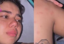 Thayane que ficou conhecida por abandonar amigo em trilha reclama de picadas de carapanãs e viraliza novamente