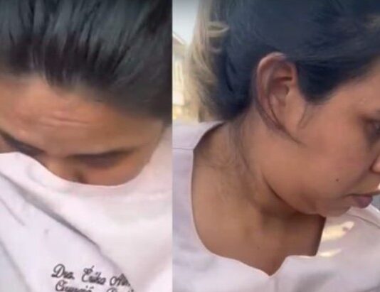 Suspeita de atuar como falsa dentista é presa enquanto atendia paciente na capital