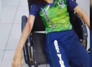 Adolescente fica ferida após ser atropelada por moto em Manacapuru