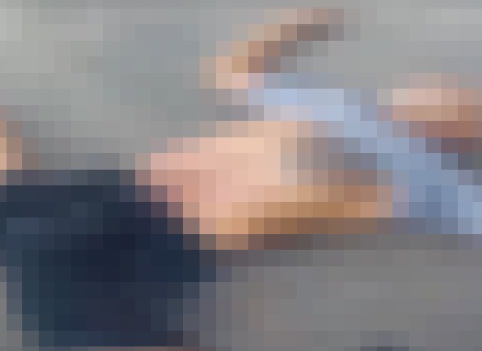 ACIDENTE
