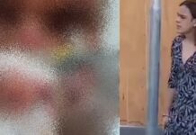 Idoso perdeu os dois olhos após ser violentado por travesti durante ‘ataque satânico’ em Manaus