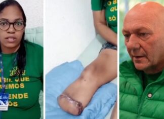 VÍDEO: Funcionária pede ajuda a Luciano Hang para comprar prótese após amputação