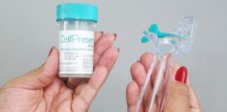 SUS disponibiliza novo teste para detecção precoce do câncer do colo do útero